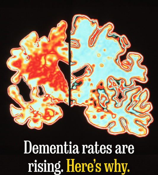 Sleep and Demenia Episode