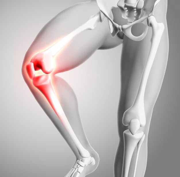 Ingredients for Conquering the Pain of Arthritis - L & L Supplement LLC