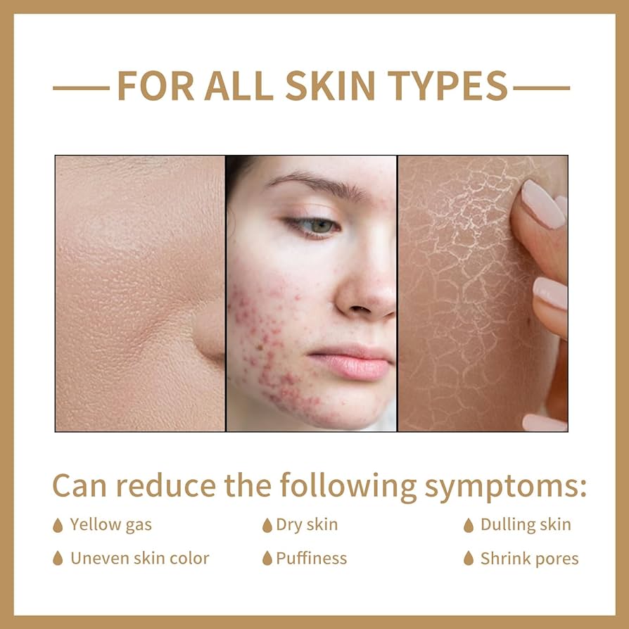 Rice Toner LL Supplement